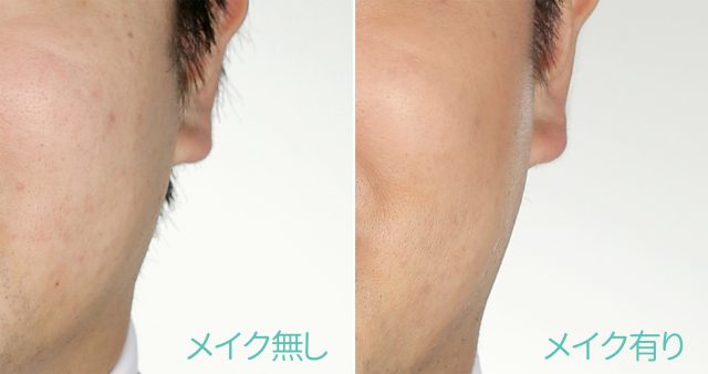 メンズメイクBefore&After　メンズメイクはココロスタジオ